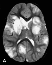 Fig. 132.1