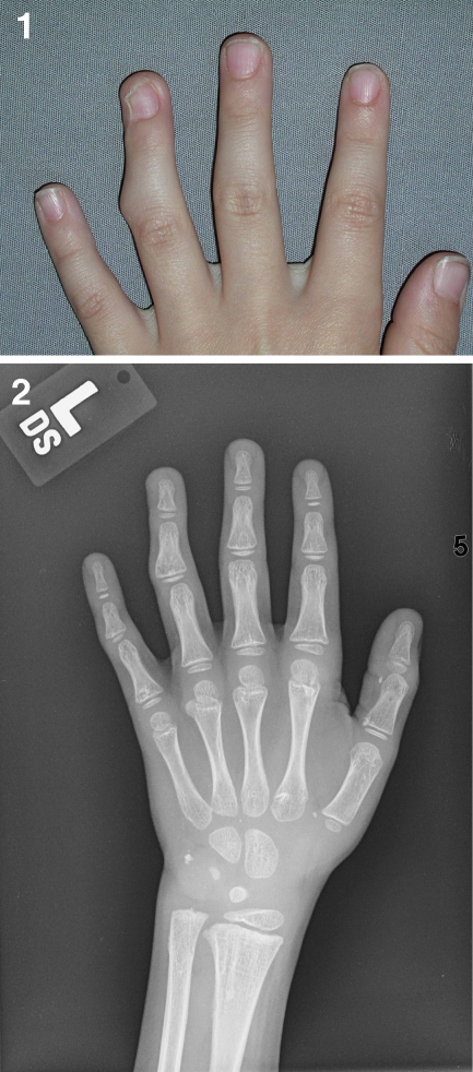 Fig. 5