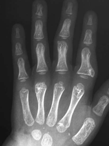 Fig. 3