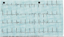 Figure 11.
