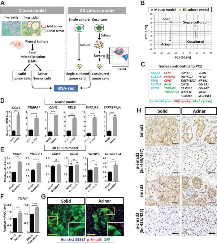 Figure 5. TGFβ signaling is activated in acinar-type tumor cells. A, Experimental scheme for RNA-seq analysis of solid- or acinar-type tumor cells derived from pleural tumors formed by A549 cells in immunodeficient mice or from tumor colonies formed by A549 cells cultured with (acinar) or without (solid) CAFs in vitro. B, PCA plots for the transcriptomes of solid- or acinar-type tumor cells determined as in A. Blue dots, cells isolated by laser microdissection (LMD) from the mouse tumor model; yellow dots, cells sorted from the 3D coculture model. C, Genes contributing to PC2 that are positively related to the change from solid-to-acinar type in the PCA analysis. Those related to the cytoskeleton (blue), to TGFβ signaling (red), or to NF-κB signaling (green) are highlighted. D and E, RT and real-time PCR analysis of genes related to TGFβ signaling (CCN2, PMEPA1, and CDH2) or to NF-κB signaling (RELB, TNFAIP3, and TNFRSF12A) in cells isolated as in A from the mouse model (D) or from the 3D coculture model (E). F, RT and real-time PCR analysis of TGFBI expression in cells as in D and E. Data in D through F were normalized by the amount of HPRT1 mRNA, are expressed relative to the corresponding value for solid-type tumor cells or single-cultured tumor cells, and are means + SD of triplicates. Each sample is pooled from three mice examined in one experiment. **, P < 0.01; ****, P < 0.0001 (unpaired two-tailed Student t test). G, Immunofluorescence staining for GFP (green) and p-Smad3 (red) in solid or acinar tumors formed after subrenal capsule injection of A549-GFP cells in immunodeficient mice. Nuclei were stained with Hoechst 33342 (blue). Scale bars, 50 μm. The images are representative of two independent experiments. H, Immunohistochemical staining for Smad2, p-Smad2, Smad3, and p-Smad3 in solid- or acinar-type tumors as in G. Scale bars, 50 μm. The images are representative of two independent experiments.