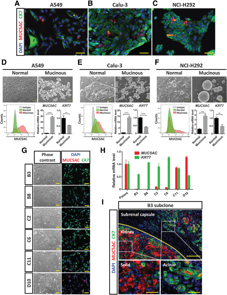 Figure 3. Lung cancer cell lines have the ability to undergo AST and SAT. A–C, Immunofluorescence staining for MUC5AC (red) and CK7 (green) in A549, Calu-3, and NCI-H292 lung cancer cells, respectively. Nuclei were stained with DAPI (blue). Scale bars, 50 μm. D–F, A549, Calu-3, and NCI-H292 cells, respectively, were cultured for 48 hours under normal or serum-free adhesion-restricted (mucinous differentiation) conditions. They were then examined by phase-contrast microscopy (top; scale bars, 100 μm) and subjected both to flow cytometric analysis of MUC5AC expression (bottom left) and to RT and real-time PCR analysis of MUC5AC and KRT7 expression (bottom right). The microscopic and flow cytometric data are representative of three independent experiments. The mRNA data were normalized by the amount of HPRT1 mRNA, are expressed relative to the corresponding value for cells cultured under the normal condition, and are means + SD from three independent experiments. **, P < 0.01; ***, P < 0.001; ****, P < 0.0001 (unpaired two-tailed Student t test). G, Phase-contrast microscopy and immunofluorescence staining for MUC5AC (red) and CK7 (green) in six A549 subclones established by single-cell cloning. Nuclei were stained with DAPI (blue). Scale bars, 50 μm. H, RT and real-time PCR analysis of MUC5AC and KRT7 expression in A549 parental cells and the six subclones. The data were normalized by the amount of HPRT1 mRNA, are expressed relative to the corresponding value for parental cells, and are means + SD of triplicates from one experiment. I, Immunofluorescence staining for MUC5AC (red) and CK7 (green) in tumors formed after injection of B3 subclone cells below the renal capsule of an immunodeficient mouse. Nuclei were stained with DAPI (blue). The top image shows the boundary (yellow line) between the kidney parenchyma and subrenal capsule regions. The kidney and subrenal capsule tumors are shown at higher magnification in the bottom left and bottom right images, respectively. The data are representative of two independent experiments. Scale bars, 200 μm (top) and 50 μm (bottom).