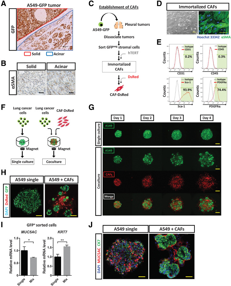 Figure 4. CAFs induce histological transition of lung cancer cells. A, Immunohistochemical staining for GFP in tumors developed after subrenal capsular injection of A549-GFP cells in immunodeficient mice. The red line demarcates a solid-type tumor in the kidney parenchyma, and the blue line an acinar-type tumor below the renal capsule. Scale bar, 200 μm. The image is representative of three independent experiments. B, Immunohistochemical staining for αSMA in solid and acinar tumors formed after subrenal capsular injection of A549-GFP cells. Scale bars, 50 μm. The images are representative of three independent experiments. C, Experimental scheme for establishment of immortalized CAFs. A549-GFP cells were injected into the pleural cavity of immunodeficient mice. After 6 weeks, pleural tumors were isolated and dissociated into single cells, GFP-negative stromal cells were collected by fluorescence-activated cell sorting, and human TERT cDNA was introduced into the stromal cells. The resulting immortalized CAFs were then labeled with DsRed. D, Phase-contrast microscopy and immunofluorescence staining for αSMA (green) in immortalized CAFs. Nuclei were stained with Hoechst 33342 (blue) in the immunofluorescence image. Scale bars, 100 μm (left) and 50 μm (right). The images are representative of three independent experiments. E, Flow cytometric analysis of CD31, CD45, Sca-1, and PDGFRα in immortalized CAFs. Data are representative of two independent experiments. F, Experimental scheme for 3D culture of GFP-labeled lung cancer cells with or without DsRed-labeled immortalized CAFs in medium containing 5% Matrigel for 4 days. G, Live imaging of GFP and DsRed fluorescence for A549-GFP colonies formed in the absence or presence of DsRed-labeled CAFs during 3D culture. Scale bars, 200 μm. The images are representative of three independent experiments. H, Confocal microscopy of GFP (green) and DsRed (red) immunofluorescence for tumor colonies formed by A549-GFP cells cultured alone or together with DsRed-labeled CAFs for 4 days. Nuclei were stained with DAPI (blue). Scale bars, 50 μm. The images are representative of three independent experiments. I, RT and real-time PCR analysis of MUC5AC and KRT7 expression in GFP+ cells sorted from A549-GFP tumor colonies formed as in H. Data were normalized by the amount of HPRT1 mRNA, are expressed relative to the corresponding value for the cells derived from CAF-free colonies, and are means + SD from two independent experiments. *, P < 0.05; **, P < 0.01 (unpaired two-tailed Student t test). J, Confocal microscopy of MUC5AC (red) and CK7 (green) immunofluorescence for tumor colonies formed as in H. Nuclei were stained with DAPI (blue). Scale bars, 50 μm. The images are representative of two independent experiments.