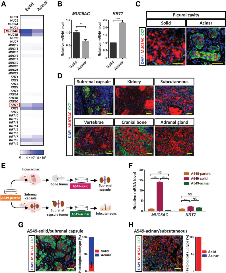 Figure 2. Environmental factors trigger SAT of A549 xenograft tumors. A, Heat map of the expression levels (counts) of mucin and cytokeratin genes determined by RNA-seq analysis of solid- or acinar-type tumor cells isolated by laser microdissection from pleural tumors formed by A549 cells in immunodeficient mice. Each sample is pooled from three mice in one experiment. B, RT and real-time PCR analysis of MUC5AC and KRT7 expression in solid- or acinar-type tumor cells isolated from pleural tumors by laser microdissection. The data were normalized by the amount of HPRT1 mRNA, are expressed relative to the corresponding value for solid-type tumor cells, and are means + SD for triplicate determinations. Each sample is pooled from three mice in one experiment. **, P < 0.01; ****, P < 0.0001 (unpaired two-tailed Student t test). C, Immunofluorescence staining for MUC5AC (red) and CK7 (green) in solid and acinar components of the same pleural tumor formed by A549 cells. Nuclei were stained with DAPI (blue). Scale bars, 50 μm. D, Immunofluorescence staining for MUC5AC (red) and CK7 (green) in A549 tumors formed at the indicated sites. Nuclei were stained with DAPI (blue). Scale bars, 50 μm. E, Experimental scheme for establishment of solid-type (A549-solid) and acinar-type (A549-acinar) tumor cells. For establishment of A549-solid cells, A549 cells (1 × 105) were injected into the left ventricle, and tumor cells were subsequently isolated from cranial bone metastases and were maintained in culture. For establishment of A549-acinar cells, A549 cells (1 × 106) were injected below the renal capsule, and cells were subsequently isolated from tumors that developed at the injection site and were maintained in culture. F, RT and real-time PCR analysis of MUC5AC and KRT7 expression in A549 parental cells, A549-solid cells, and A549-acinar cells. Data were normalized by the amount of HPRT1 mRNA, are expressed relative to the corresponding value for A549 parental cells, and are means + SD for triplicates of one of two independent experiments that yielded similar results. **, P < 0.01; ****, P < 0.0001; NS, not significant; by two-way ANOVA with Tukey multiple-comparison test. G and H, A549-solid cells were injected below the renal capsule (G), and A549-acinar cells were injected subcutaneously (H). The tumors that formed at each injection site were subjected to immunofluorescence staining for MUC5AC (red) and CK7 (green), and the percentage area of each histological subtype within individual tumors was determined. Nuclei were stained with DAPI (blue). Scale bars, 50 μm. The quantitative data are means ± SEM for three tumors at each site derived from three independent experiments.