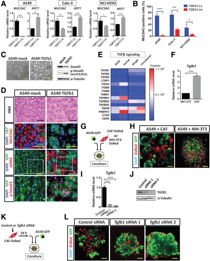 Figure 6. TGFβ1 signaling mediated by CAFs contributes to SAT induction in lung cancer cells. A, RT and real-time PCR analysis of MUC5AC and KRT7 expression in A549, Calu-3, and NCI-H292 lung cancer cells cultured in the absence or presence of TGFβ1 (2 ng/mL) for 24 hours. Data were normalized by the amount of HPRT1 mRNA, are expressed relative to the corresponding value for cells cultured in the absence of TGFβ1, and are means + SD from three independent experiments. *, P < 0.05; **, P < 0.01; ***, P < 0.001; ****, P < 0.0001 (unpaired two-tailed Student t test). B, Flow cytometric analysis of MUC5AC expression in A549, Calu-3, and NCI-H292 cells cultured under mucinous differentiation conditions in the absence or presence of TGFβ1 (2 ng/mL) for 48 hours. Data are means + SD for the percentage of MUC5AC-positive cells from three independent experiments (a representative experiment is shown in Supplementary Fig. S5A). *, P < 0.05; ***, P < 0.001; ****, P < 0.0001 (unpaired two-tailed Student t test). C, Phase-contrast microscopy of (left; scale bars, 50 μm) as well as immunoblot analysis (right) of Smad3 and p-Smad3 in A549-TGFb1 cells (expressing GFP and an active form of TGFβ1) and control (A549-mock) cells. α-Tubulin was examined as a loading control for immunoblot analysis. Data are representative of two independent experiments. D, Hematoxylin and eosin (H&E) staining as well as immunofluorescence staining for MUC5AC (red) and CK7 (green), GFP (green) and αSMA (red), or GFP (green) and p-Smad3 (red), as indicated, in subcutaneous tumors formed by A549-mock or A549-TGFb1 cells in immunodeficient mice. Nuclei were stained with DAPI (blue) in the immunofluorescence images. Scale bars, 50 μm. Data are representative of three independent experiments. E, Heat map of expression levels (counts) of TGFβ signaling–related genes derived from RNA-seq data of solid- and acinar-type tumor cells from both xenograft tumor and 3D coculture models (see Fig. 5A). F, RT and real-time PCR analysis of Tgfb1 expression in NIH3T3 fibroblasts and immortalized mouse CAFs. Data were normalized by the amount of B2 m mRNA, are expressed relative to the value for NIH3T3 cells, and are means + SD of triplicates from one of two similar experiments. ****, P < 0.0001 (unpaired two-tailed Student t test). G, Experimental scheme for 3D coculture of A549-GFP cells with CAF-DsRed or NIH3T3–DsRed cells for 4 days. H, Confocal microscopy of GFP (green) and DsRed (red) immunofluorescence in colonies formed as in G. Nuclei were stained with DAPI (blue). Scale bars, 50 μm. The images are representative of two independent experiments. I and J, RT and real-time PCR analysis of Tgfb1 mRNA (I) and immunoblot analysis of TGFβ1 (J) in CAF-DsRed cells transfected with a control siRNA or Tgfb1 siRNAs 1 or 2 for 48 hours. The RT-PCR data were normalized by the amount of B2 m mRNA, are expressed relative to the value for cells transfected with the control siRNA, and are means + SD from three independent experiments. ****, P < 0.0001 (unpaired two-tailed Student t test). The immunoblot data are representative of two independent experiments. K, Experimental scheme for 3D coculture of A549-GFP cells with CAF-DsRed cells transfected with siRNAs as in I and J. L, Confocal microscopy of GFP (green) and DsRed (red) immunofluorescence in colonies formed after 4 days in culture as in K. Nuclei were stained with DAPI (blue). Scale bars, 50 μm. The images are representative of two independent experiments.