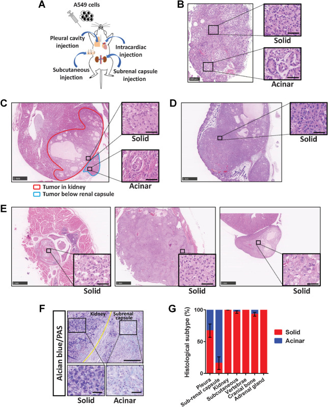 Figure 1. A549 cells form tumors of distinct histological subtypes depending on their site of development. A, Experimental scheme for establishment of A549 xenograft tumor models. A549 cells were injected into the pleural cavity, subcutaneously, into the left ventricle, or below the renal capsule of immunodeficient mice. B–E, Representative hematoxylin–eosin staining of tumors formed at 6 weeks after A549 cell injection via the four routes. B, A tumor that developed in the pleural cavity. The boxed regions on the left are shown at higher magnification on the right and correspond to solid- or acinar-type histology. Scale bars, 200 μm (left) and 50 μm (right). C, Tumors that developed in the kidney parenchyma (red outline) or below the renal capsule (blue outline) showed solid- and acinar-type histology, respectively. D, A subcutaneous tumor showing solid-type histology. E, Vertebral (left), cranial bone (middle), and adrenal gland (right) metastases formed after intracardiac injection of A549 cells all exhibited solid-type histology. Scale bars (C–E), 1,000 μm (low-power fields) and 50 μm (high-power fields). F, Alcian blue and periodic acid–Schiff staining of tumors formed after subrenal capsule injection of A549 cells. The tumor in the kidney (solid) showed a higher level of acidic mucin stained with Alcian blue than did that below the renal capsule (acinar). Scale bars, 200 μm (top) and 50 μm (bottom). G, The percentage area of each histological subtype within individual A549 xenograft tumors. Data are means ± SEM for three or four tumors at each site derived from at least three independent experiments.