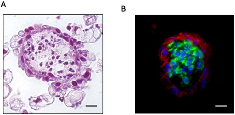 Figure 2: