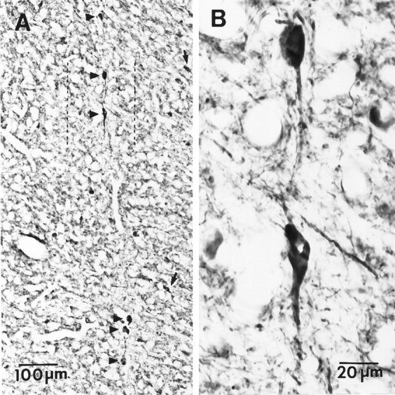 Fig. 14.