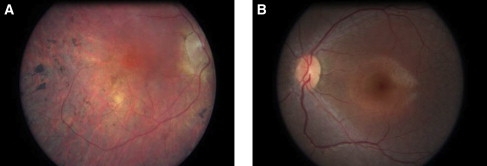 Figure 2