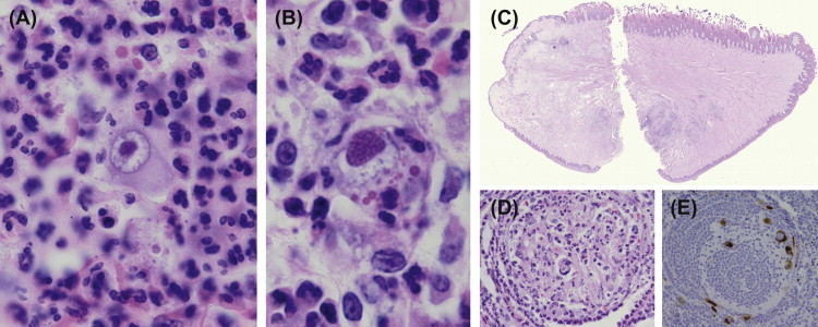 FIGURE 1.8