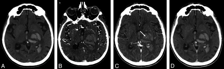 Fig 1.