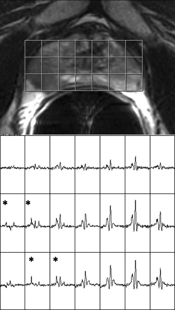 Figure 4b: