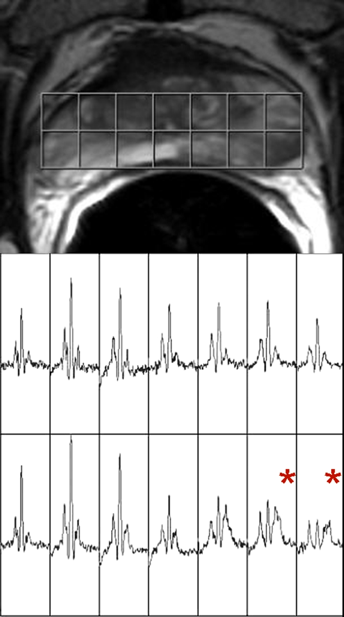 Figure 3b: