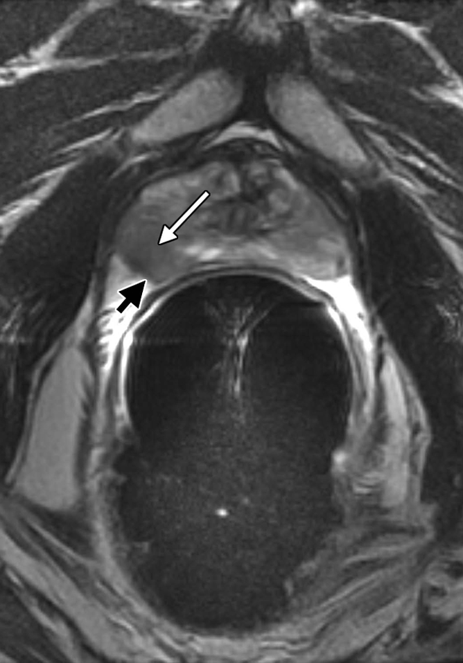 Figure 4a: