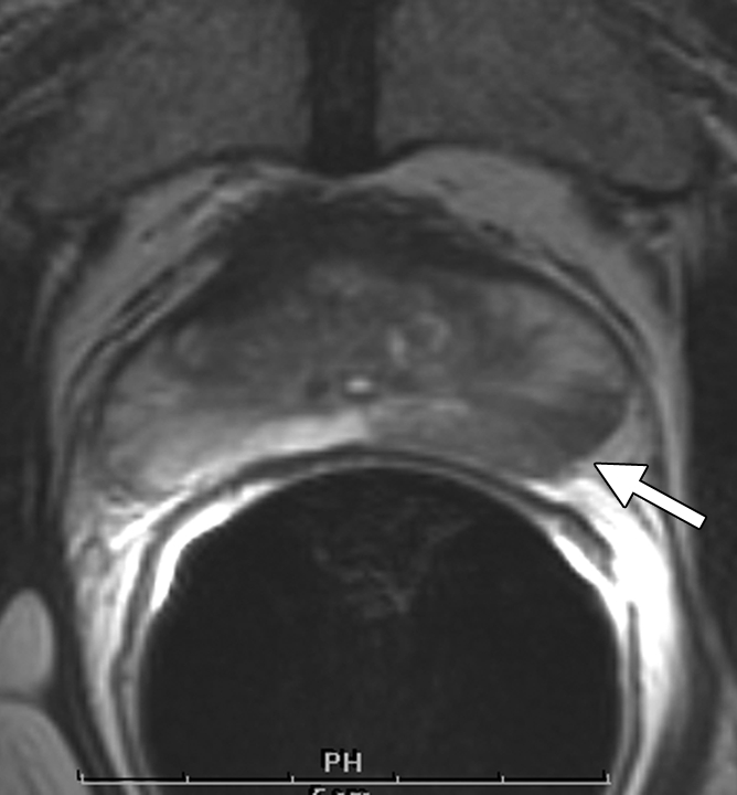 Figure 3a: