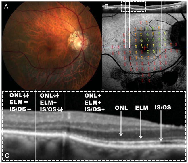 Fig. 3