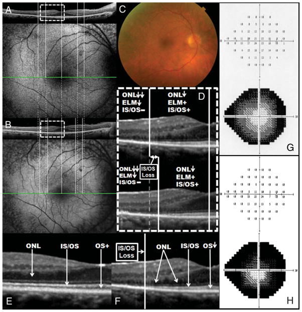 Fig. 4