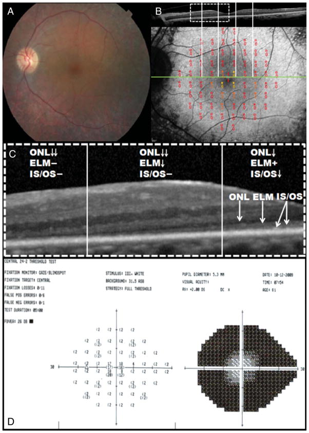 Fig. 2