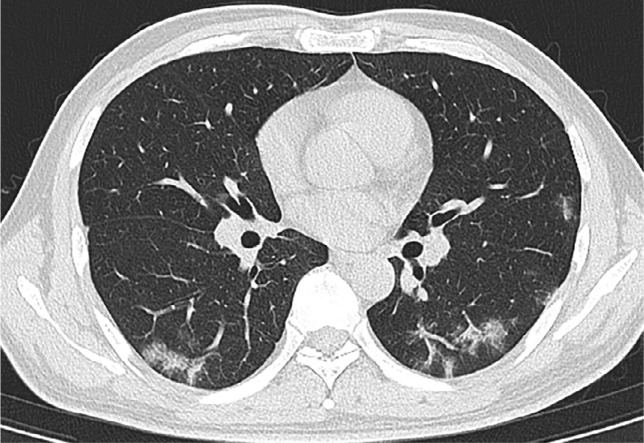 Figure 2c: