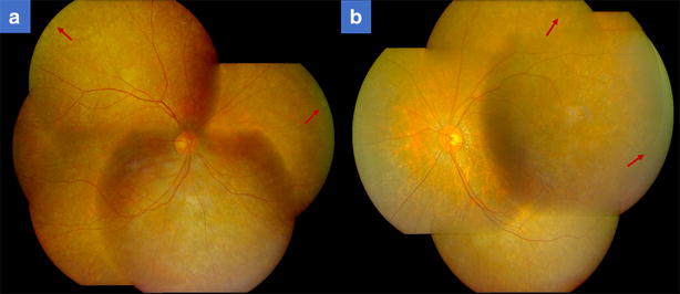 Fig. 2