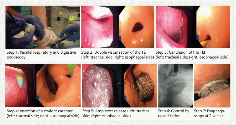 Fig. 2