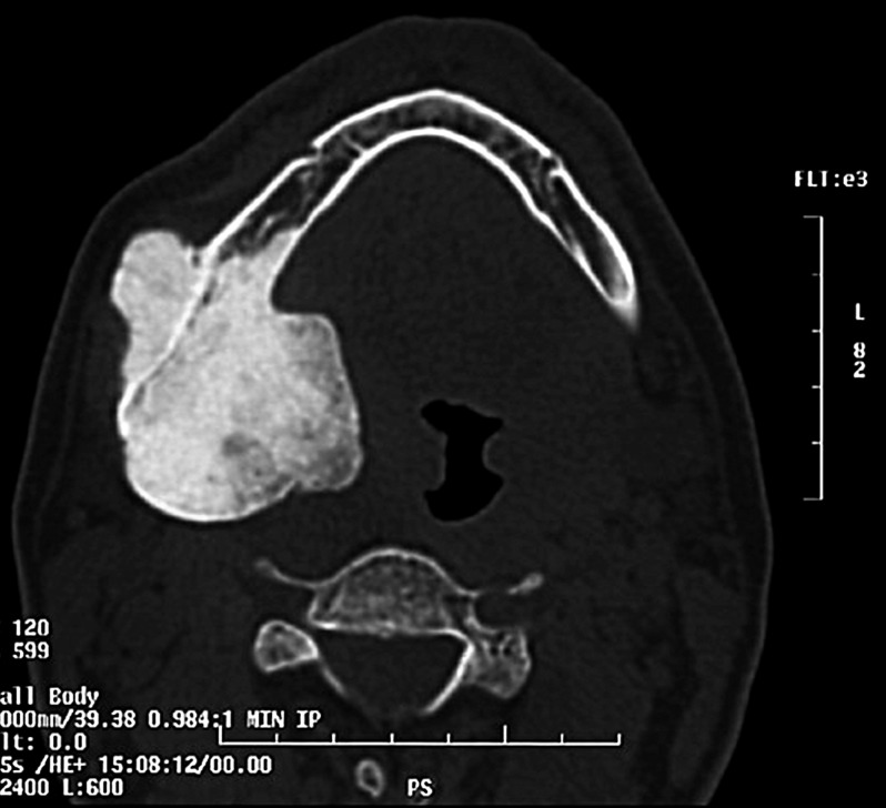 Fig. 2.