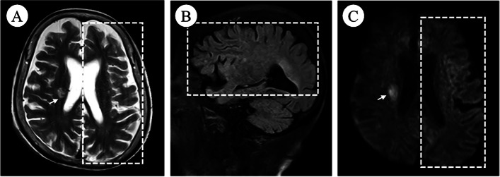 Fig. 2