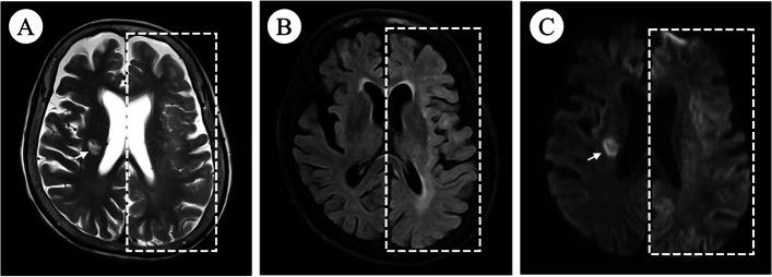 Fig. 4