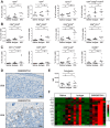 Figure 6. GSK2857916 enhances intratumor immune cell infiltration and activation. Quantification by flow cytometry of immune cells infiltrating C57BL/6 mice bearing EL4-hBCMA tumors following treatment with GSK2857916 or isotype control (at 15 mg/kg), or saline vehicle. A, CD8+, CD4+, and regulatory (CD4+CD25+FoxP3+) T cells, and DC (CD11c+). B, T-cell activation markers CD25, CD69, and ICOS and the exhaustion marker PD-1. C, Quantification of the DC costimulatory molecule CD86, T-cell proliferation (Ki67) and cytotoxicity (granzyme B, GrzB) in TILs and NK cells (CD49b+). A one-way ANOVA statistical analysis was performed. ns, not significant; *, P < 0.05; **, P < 0.01; ***, P < 0.001; ****, P ≤ 0.0001. D, IHC for CD8 reactive cells in mice bearing EL4-hBCMA tumors treated with GSK2857914 (top) or GSK2857916 (bottom) at 15 mg/kg (as in Fig. 4). Representative images, 20× magnification. E, Quantification of calreticulin cell surface expression (MFI) on tumor cells in mice. F, Heatmap depicting a type I IFN-related gene signature following treatment with saline, isotype control or GSK2857916 (at 15 mg/kg) from the same experiment as in (A–C, E). Each column represents an individual mouse and each row an individual gene.