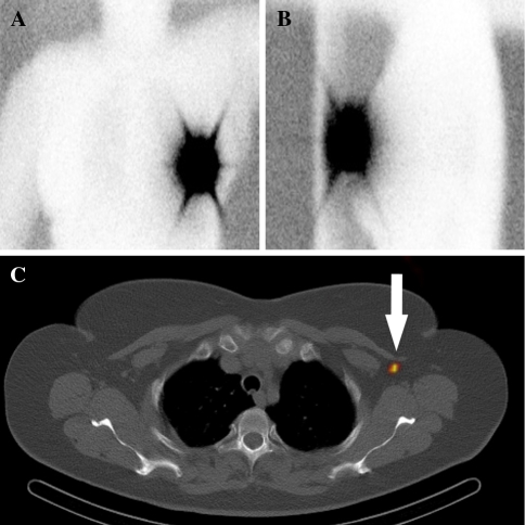 Fig. 1