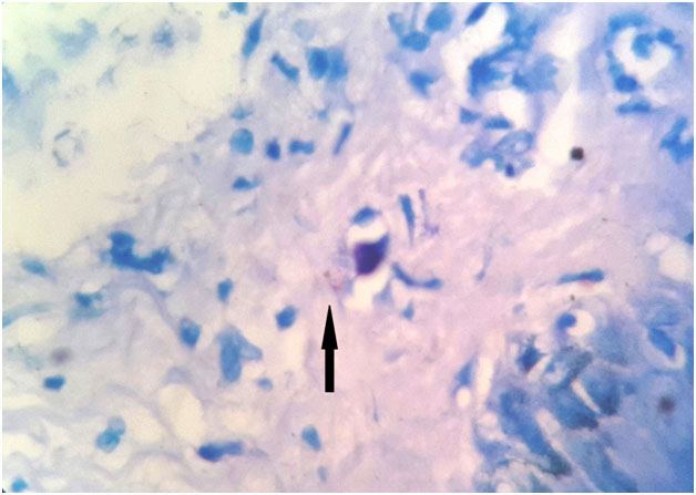 [Table/Fig-5]: