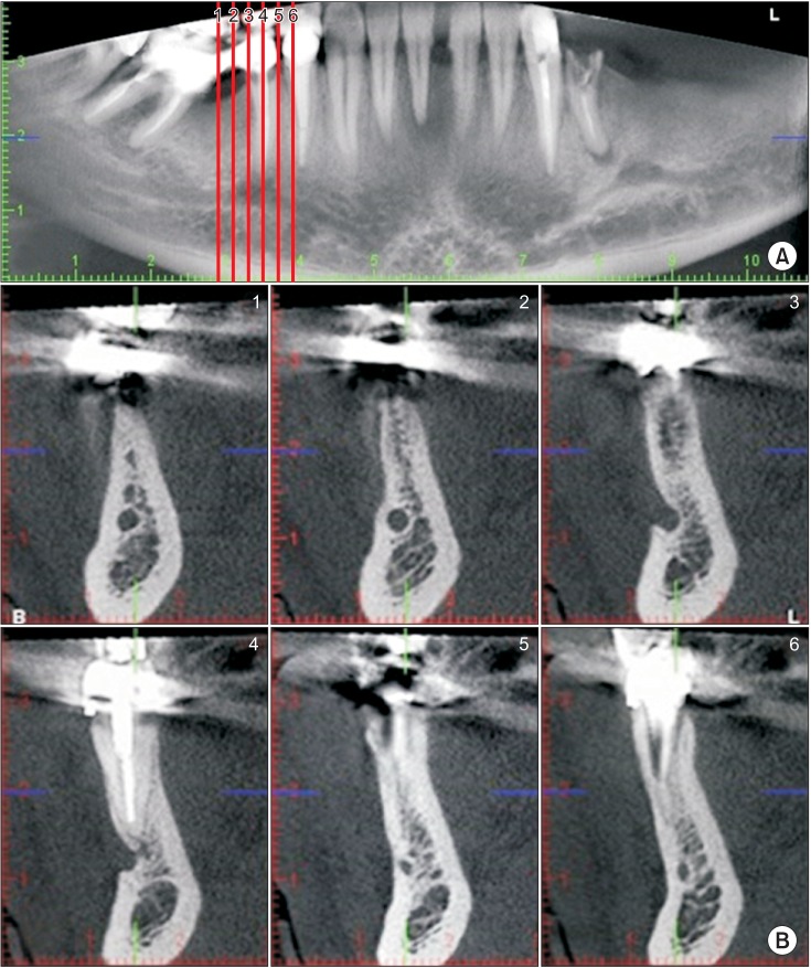 Fig. 3