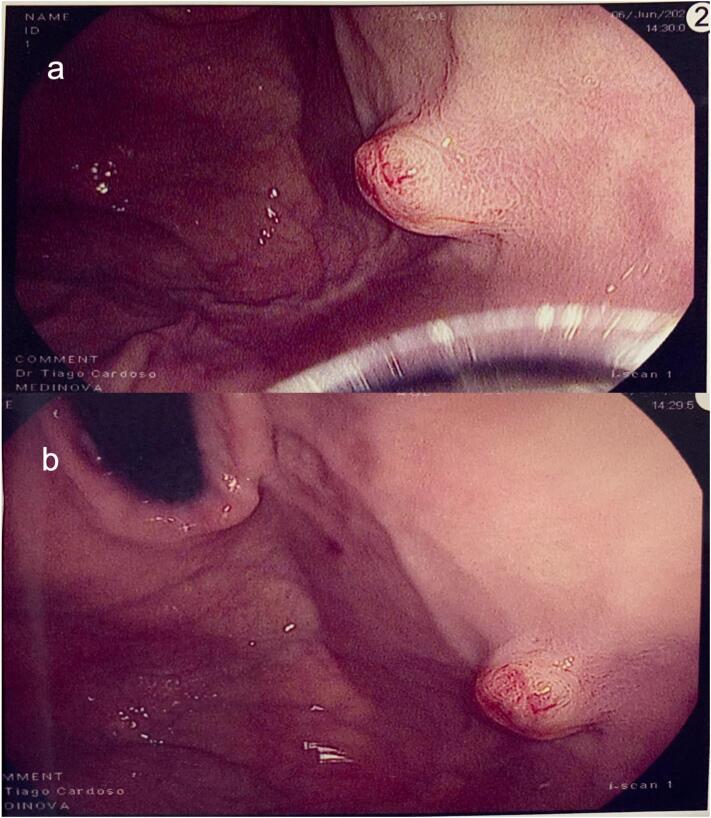 Fig. 2