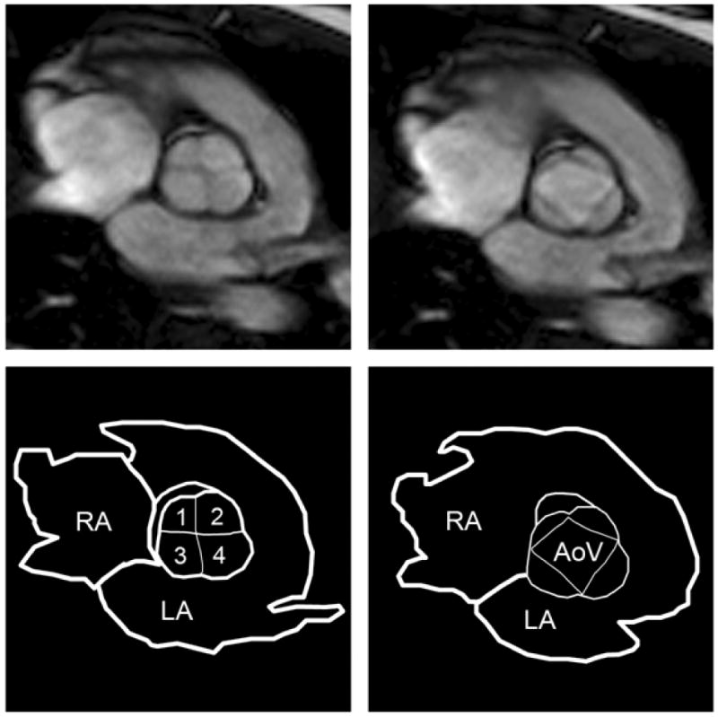 FIG. 4