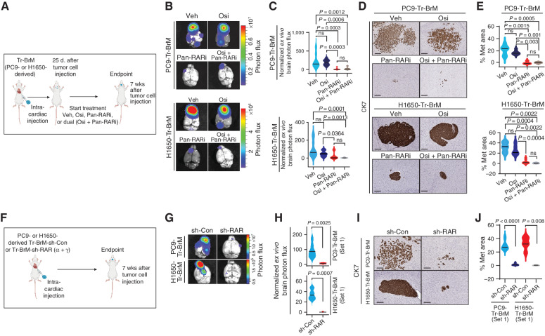 Figure 6. Osimertinib-refractory cancer cells are sensitive to pan-RAR inhibition. A, Schematic representation of the treatment of PC9- and H1650-derived Tr-BrM cells with vehicle, osimertinib alone, a pan-RAR antagonist (AGN194310) alone, or AGN194310 in combination with osimertinib. At 25 days after tumor cell injection, after confirmation of metastatic signal, mice were administered long-term treatment with either (i) vehicle (Veh), (ii) AGN194310 (Pan-RARi; 0.5 mg/kg body weight/day), (iii) osimertinib (Osi; 5 mg/kg body weight/day), or (iv) AGN194310 (0.5 mg/kg body weight/day) plus osimertinib (5 mg/kg body weight/day) by oral gavage 5 days per week until the endpoint (7 weeks after tumor cell injection). B, Ex vivo photon flux of posttreatment brains from the experiment described in A was determined at endpoint by bioluminescence imaging. The photon-flux scale is indicated on the right. C, Violin plots depicting normalized photon flux of brains imaged ex vivo from the mice described in B. The normalized photon flux for brain tissue was calculated by dividing the photon flux from brain collected ex vivo by the total photon flux at day 0 (i.e., the day of injection) and multiplying that value by 100. Data are presented as mean values ± SEM. P values were determined by a two--tailed, unpaired Mann–Whitney test. For PC9-Tr-BrM mice: n = 8 for vehicle; n = 8 for osimertinib; n = 7 for pan-RARi; and n = 7 for osimertinib plus pan-RARi. For H1650-Tr-BrM mice: n = 12 for vehicle; n = 8 for osimertinib; n = 10 for pan-RARi; and n = 6 for osimertinib plus pan-RARi. ns, P value not significant. D, Representative images of CK7 IHC on posttreatment brain sections collected at endpoint from the experiment described in A. Scale bars, 200 μm for top (PC9-Tr-BrM) and 100 μm for bottom (H1650-Tr-BrM). E, Quantitative analysis of the percentage of CK7-immunostained brain sections covered by metastasis (Met) shown in D. Data are presented as mean values ± SEM. P values were determined by a two-tailed, unpaired Mann–Whitney test. For PC9-Tr-BrM mice: n = 11 for vehicle; n = 9 for osimertinib; n = 4 for pan-RARi; and n = 5 for osimertinib plus pan-RARi. For H1650-Tr-BrM mice: n = 6 for vehicle; n = 6 for osimertinib; n = 9 for pan-RARi; and n = 6 for osimertinib plus pan-RARi. F, Schematic representation of the experiment testing the effect of RAR gene knockdown on brain metastasis development. Mice were injected with either PC9- or H1650-derived Tr-BrM cells with one of two sets of shRNA-mediated stable dual knockdown of RARα and RARγ (sh-RARα + γ), or control shRNA (sh-Con), via intracardiac injection. Experiments involving shRNA set #1 are shown in G–J, whereas experiments involving shRNA set #2 are shown in Supplementary Fig. S6L–S6O. Mice were euthanized 7 weeks after tumor cell injection, and brains were collected for analysis. G, Ex vivo photon flux of posttreatment brains from the experiment described in F was determined at endpoint by bioluminescence imaging. The photon-flux scale is indicated on the right. H, Violin plots depicting normalized photon flux of brains imaged ex vivo from the mice represented in G. The normalized photon flux for brain tissue was calculated by dividing the photon flux from brain collected ex vivo by the total photon flux at day 0 (i.e., the day of injection) and multiplying that value by 100. Data are presented as mean values ± SEM. P values were determined by a two--tailed, unpaired Mann–Whitney test. For PC9-Tr-BrM: n = 7 for sh-Con; n = 5 for sh-RAR. For H1650-Tr-BrM: n = 8 for sh-Con; n = 6 for sh-RAR. I, Representative images of CK7 IHC on posttreatment brain sections collected at endpoint from the experiment described in F. Scale bars, 100 μm for all images. J, Quantitative analysis of the percentage of CK7-immunostained brain sections covered by metastasis shown in I. Data are presented as mean values ± SEM. P values were determined by a two-tailed, unpaired Mann–Whitney test. For PC9-Tr-BrM: n = 10 for sh-Con; n = 10 for sh-RAR. For H1650-Tr-BrM: n = 5 for sh-Con; n = 5 for sh-RAR.