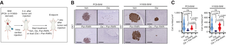 Figure 7. The combination of osimertinib and pan-RAR antagonism reduces residual cancer cells in the brain. A, Schematic representation of the experimental treatment protocol for the prevention trial. Osimertinib-sensitive PC9- or H1650-BrM cells were injected into mice via intracardiac injections. At 5 days after tumor cell injection, mice were administered treatment with either (i) vehicle (Veh), (ii) AGN194310 (Pan-RARi; 0.5 mg/kg body weight/day), (iii) osimertinib (Osi; 5 mg/kg body weight/day), or (iv) AGN194310 (0.5 mg/kg body weight/day) plus osimertinib (5 mg/kg body weight/day) by oral gavage 5 days per week until the endpoint (7 weeks after tumor cell injection). B, Representative images of CK7 IHC on posttreatment brain sections at endpoint from the experiment described in A. Scale bars, 500 μm for PC9-BrM and 100 μm for H1650-BrM. C, Quantitative analysis of the CK7-immunostained brain metastatic cancer cell number per μm2 represented in B. Data are presented as the mean number of cancer cells per μm2 of the brain tissue section ± SEM. P values were determined by a two-tailed, unpaired Mann–Whitney test. For PC9-BrM: n = 12 for vehicle; n = 16 for osimertinib; n = 10 for pan-RARi; and n = 10 for osimertinib plus pan-RARi. For H1650-BrM: n = 17 for vehicle; n = 12 for osimertinib; n = 10 for pan-RARi; and n = 14 for osimertinib plus pan-RARi. ns, P value not significant.