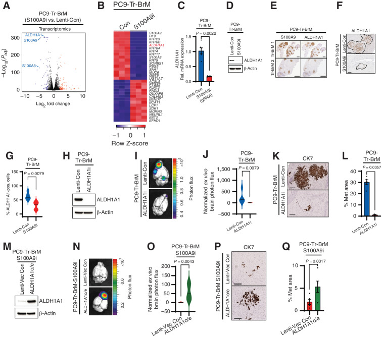 Figure 5. S100A9 promotes brain relapse through ALDH1A1. A, Volcano plot shows the significantly differentially expressed genes between PC9-Tr-BrM cells expressing either Lenti-Con or S100A9i gRNAs as identified by RNA-seq analysis. Genes with significantly higher expression in PC9-Tr-BrM-S100A9i cells compared with PC9-Tr-BrM-Lenti-Con cells have log2 fold changes with positive values and are depicted in red. Genes with significantly lower expression in PC9-Tr-BrM-S100A9i cells compared with PC9-Tr-BrM-Lenti-Con cells have log2 fold changes with negative values and are depicted in blue. N = 3 per group. Genes with an adjusted P value of less than 1.0 × 10−4 and an absolute value of the log2 fold change of greater than 2.4 were considered significant. B, Heat map of the top significantly upregulated and downregulated genes in PC9-Tr-BrM–derived S100A9i-expressing cells versus Lenti-Con–expressing cells (Con). Normalized gene expression above the row mean is indicated by progressively darker shades of red, and normalized gene expression below the row mean is indicated by progressively darker shades of blue. Genes with an adjusted P value of less than 1.0 × 10−4 and an absolute value of the log2 fold change of greater than 2.4 were considered significant. C, ALDH1A1 expression was determined by qRT--PCR analysis in PC9-derived Tr-BrM cells expressing either Lenti-Con or S100A9i. GAPDH was measured as an internal control. Data are presented as mean values ± SEM. The P value was determined by a two-tailed, unpaired Mann–Whitney test: n = 6 for Lenti-Con and n = 6 for S100A9i. D, Immunoblot analysis of lysates from PC9-Tr-BrM cells expressing either Lenti-Con or S100A9i using antibodies against ALDH1A1 and β-actin (loading control). The data are representative of three independent experiments. Rel., relative. E, Representative images of serial brain sections stained with an antibody against S100A9 (left) and ALDH1A1 (right) taken from two different mice (designated “Tr-BrM 1” and “Tr-BrM 2”) injected with PC9-Tr-BrM cells. Brains were collected at 7 weeks after tumor cell injection. Images are representative of eight mice analyzed per group. Scale bars, 2,000 μm. F, Representative images of brain sections stained with an antibody against ALDH1A1 taken from mice injected with PC9-Tr-BrM cells expressing either Lenti-Con or S100A9i and collected 7 weeks after tumor cell injection. Scale bars, 200 μm. G, Quantitative analysis of the ALDH1A1-positive cells (pos.) shown in F. Immunostained sections were counted using the QuPath software, where positively stained cells were identified by setting a threshold for signal intensity (1+). Data are presented as mean values ± SEM. The P value was determined by a two--tailed, unpaired Mann–Whitney test: n = 5 for Lenti-Con and n = 5 for S100A9i. H, Immunoblot analysis of lysates from PC9-Tr-BrM cells expressing either Lenti-Con or ALDH1A1i using antibodies against ALDH1A1 and β-actin (loading control). The data are representative of three independent experiments. I, Ex vivo photon flux of brains from mice injected with PC9-Tr-BrM–derived cells expressing either Lenti-Con or ALDH1A1i was determined by bioluminescence imaging. Brains were collected from mice 7 weeks after tumor cell injection. Photon-flux scale is indicated on the right side. J, Violin plots depicting normalized photon flux of brains imaged ex vivo from the mice described in I. The normalized photon flux for brain tissue was calculated by dividing the photon flux from brain collected ex vivo by the total photon flux at day 0 (i.e., the day of injection) and multiplying that value by 100. Data are presented as mean values ± SEM. The P value was determined by a two--tailed, unpaired Mann–Whitney test: n = 5 for Lenti-Con and n = 5 for ALDH1A1i. K, Representative images from CK7 IHC on brain sections from mice injected with PC9-Tr-BrM-Lenti-Con cells (top) or PC9-Tr-BrM-ALDH1A1i cells (bottom). Brains were harvested from mice 7 weeks after tumor cell injection. Scale bars, 200 μm. L, Quantitative analysis of the percentage of CK7-immunostained brain sections covered by metastasis from the experiment described in K. Data are presented as mean values ± SEM. The P value was determined by a two-tailed, unpaired Mann–Whitney test: n = 5 for Lenti-Con and n = 3 for ALDH1A1i. M, Immunoblot analysis of lysates from PC9-Tr-BrM-S100A9i cells expressing either lenti-vector control (Lenti-Vec Con) or ALDH1A1 (“ALDH1A1o/e” denotes ALDH1A1 overexpression) using antibodies against ALDH1A1 and β-actin (loading control). Data are representative of three independent experiments. N, Ex vivo photon flux of brains from mice injected with PC9-Tr-BrM-S100A9i cells expressing either Lenti-Vec Con or ALDH1A1 was determined by bioluminescence imaging. Brains were collected from mice 7 weeks after tumor cell injection. The photon-flux scale is indicated on the right. O, Violin plots depicting normalized photon flux of brains imaged ex vivo from the mice described in N. The normalized photon flux for brain tissue was calculated by dividing the photon flux from brain collected ex vivo by the total photon flux at day 0 (i.e., the day of injection) and multiplying that value by 100. Data are presented as mean values ± SEM. The P value was determined by a two--tailed, unpaired Mann–Whitney test: n = 6 for Lenti-Vec Con; n = 5 for ALDH1A1o/e. P, Representative images of CK7 IHC on brain sections from mice injected with PC9-Tr-BrM S100A9i cells expressing either Lenti-Vec Con (top) or ALDH1A1 (bottom). Brains were harvested from mice 7 weeks after tumor cell injection. Scale bars, 200 μm. Q, Quantitative analysis of the percentage of CK7-immunostained brain sections covered by metastasis (Met) from the experiment described in P. Data are presented as mean values ± SEM. The P value was determined by a two-tailed, unpaired Mann–Whitney test: n = 5 for Lenti-Vec Con and n = 6 for ALDH1A1o/e.