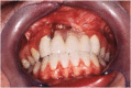 Fig. 2b