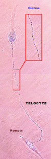 Fig 15