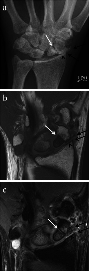 Fig. 12