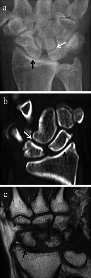 Fig. 9