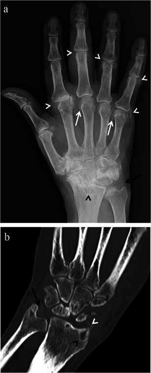 Fig. 13