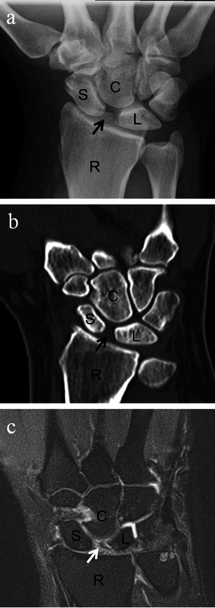 Fig. 2