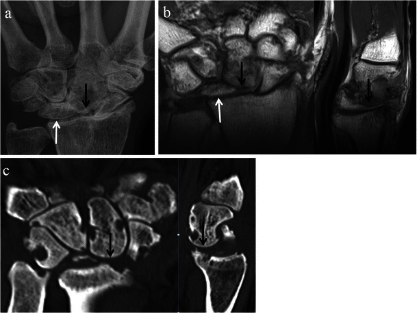 Fig. 11