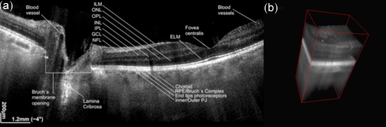 Fig. 13