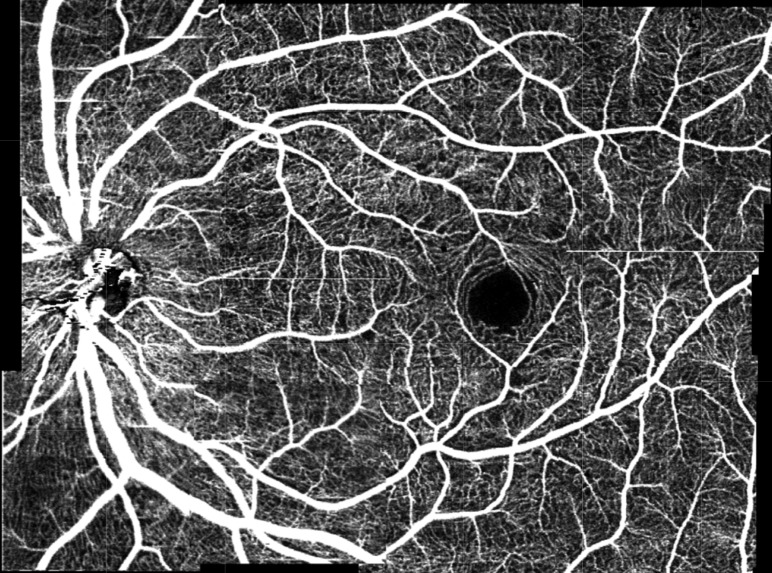 Fig. 11