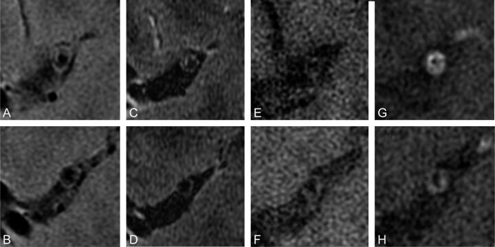 Fig 3.