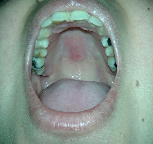 Figure 2.