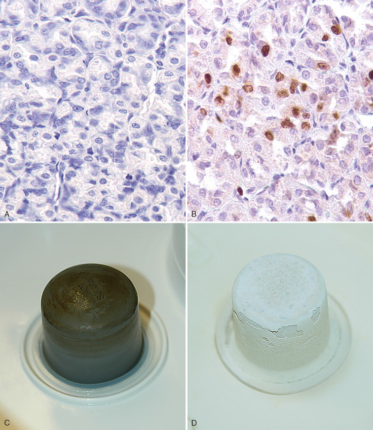FIGURE 17-1