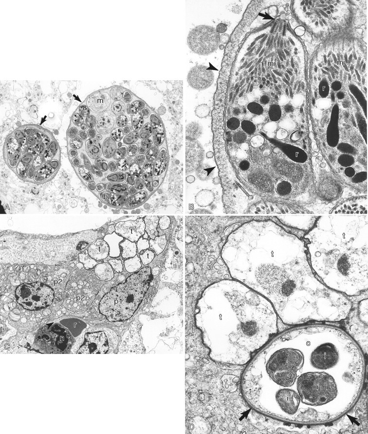 FIGURE 17-5